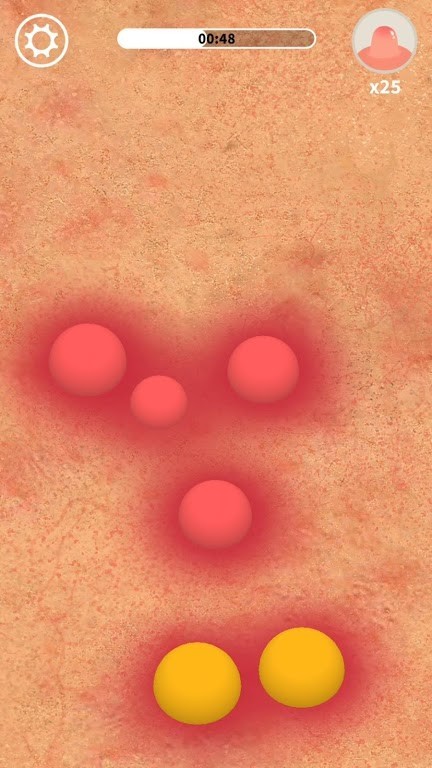 我挤粉刺贼6游戏截图3