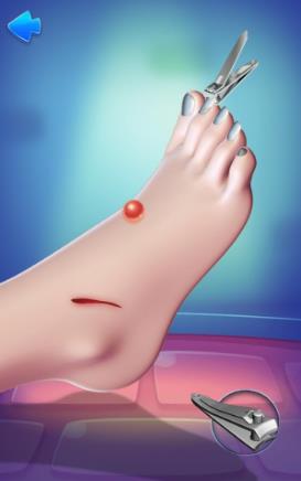 脚部护理模拟游戏截图3