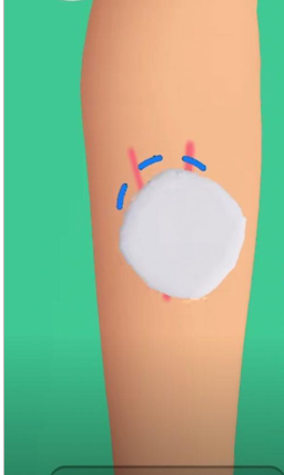 大针筒护士游戏截图2