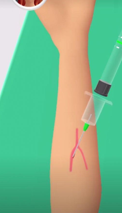 大针筒护士游戏截图3